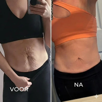 Auveya® BodySculpt